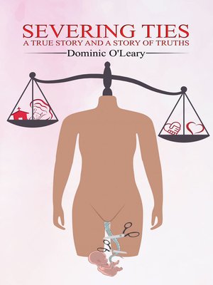 cover image of Severing Ties